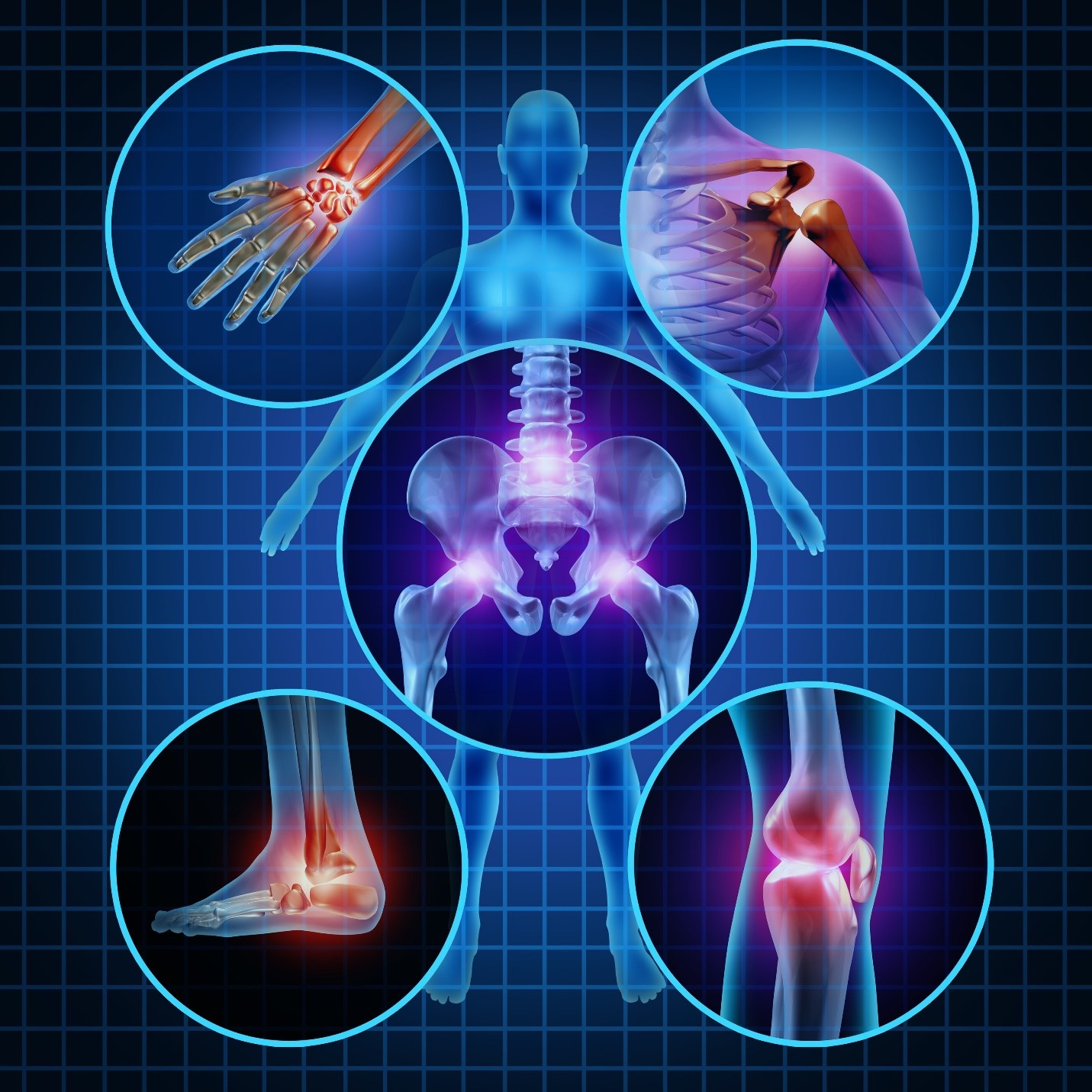 আর্থ্রাইটিস (বাত ব্যথা) - Dr. Farzana Yeasmin Ety Arthritis-Dr Farzana Yeasmin Ety