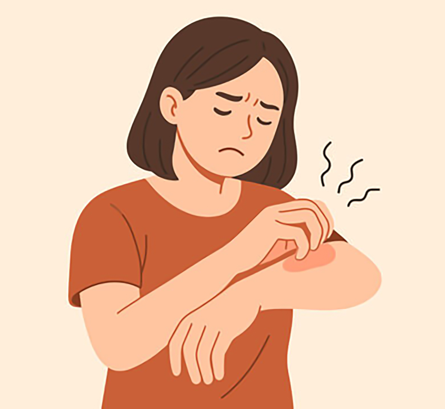দাদ ও একজিমা - Dr. Farzana Yeasmin Ety Eczema-Dr Farzana Yeasmin Ety