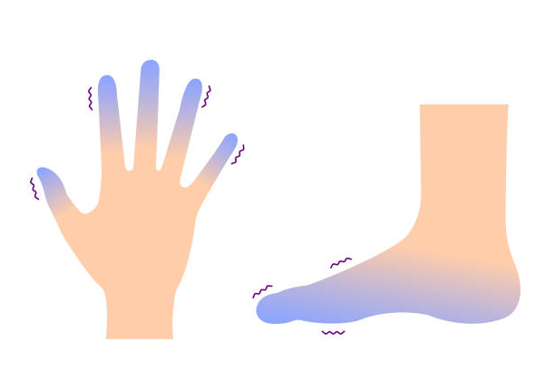 হাত-পা জ্বালাপোড়া - Dr. Farzana Yeasmin Ety Hand Foot Irretation- Dr. Farzana Yeasmin Ety